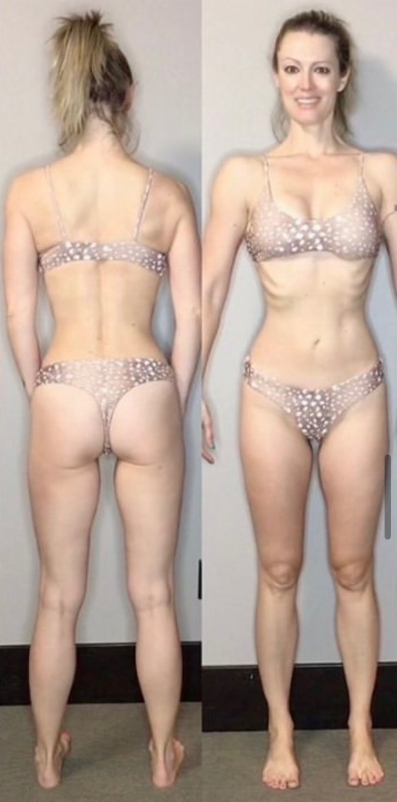 Client after, back and front view
