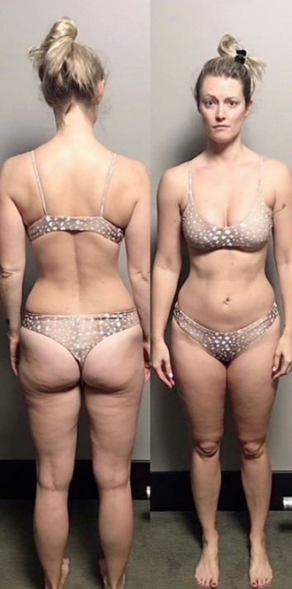 Client before, back and front view